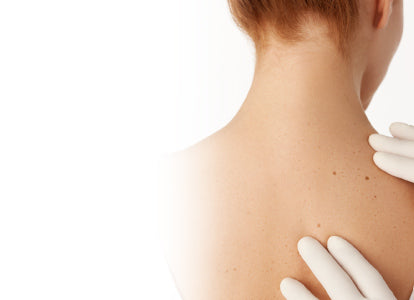 BodyCare - Body Acne